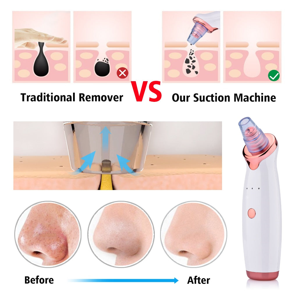 Electric Facial Washing